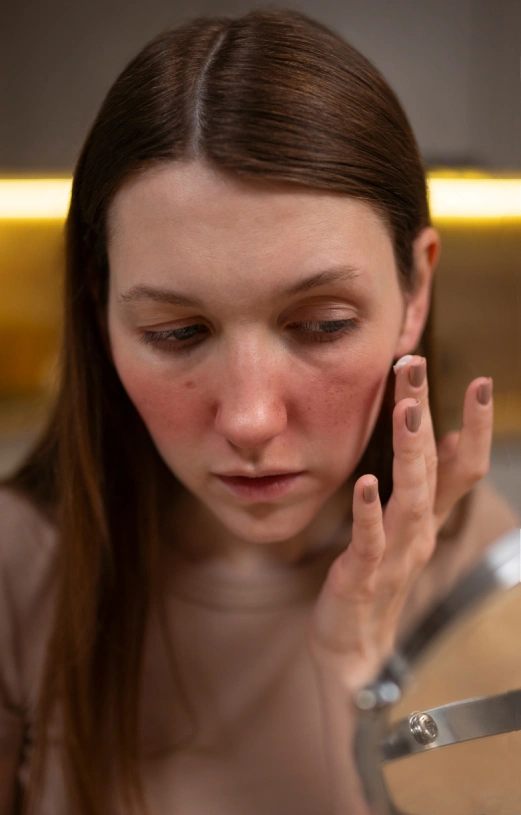 Treatment Acne Scarring Transformation Package