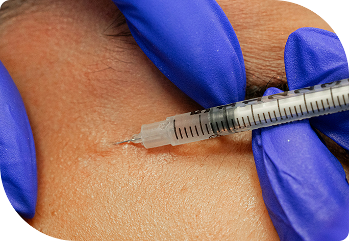 Post-TCA Peel London Downtime