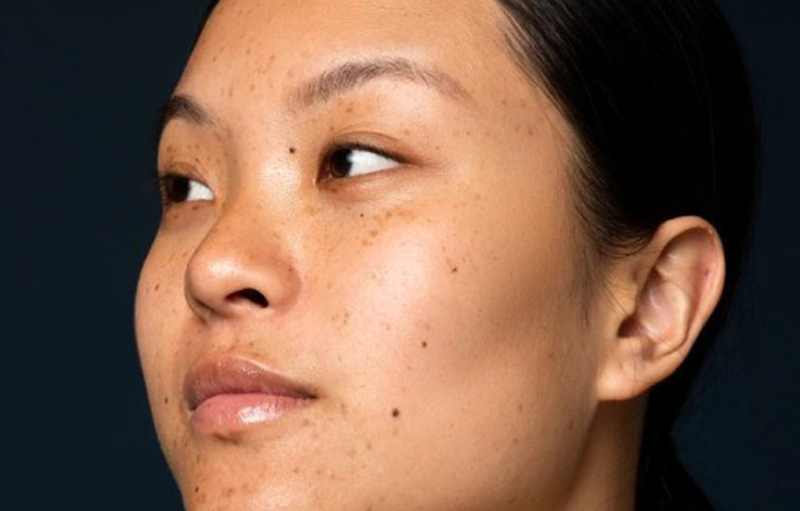 Are novices seeking safe, conservative enhancement?