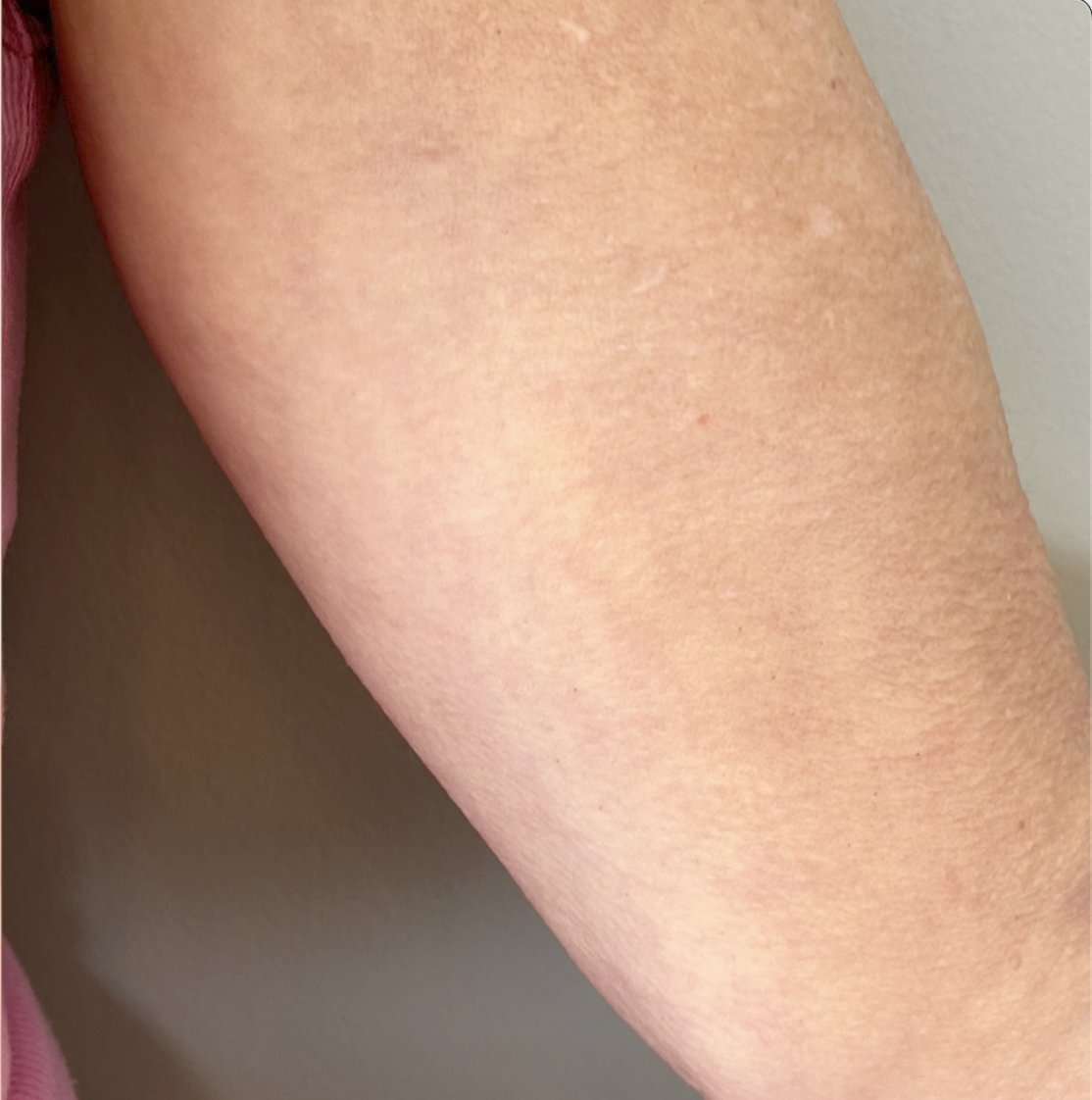 After treatment