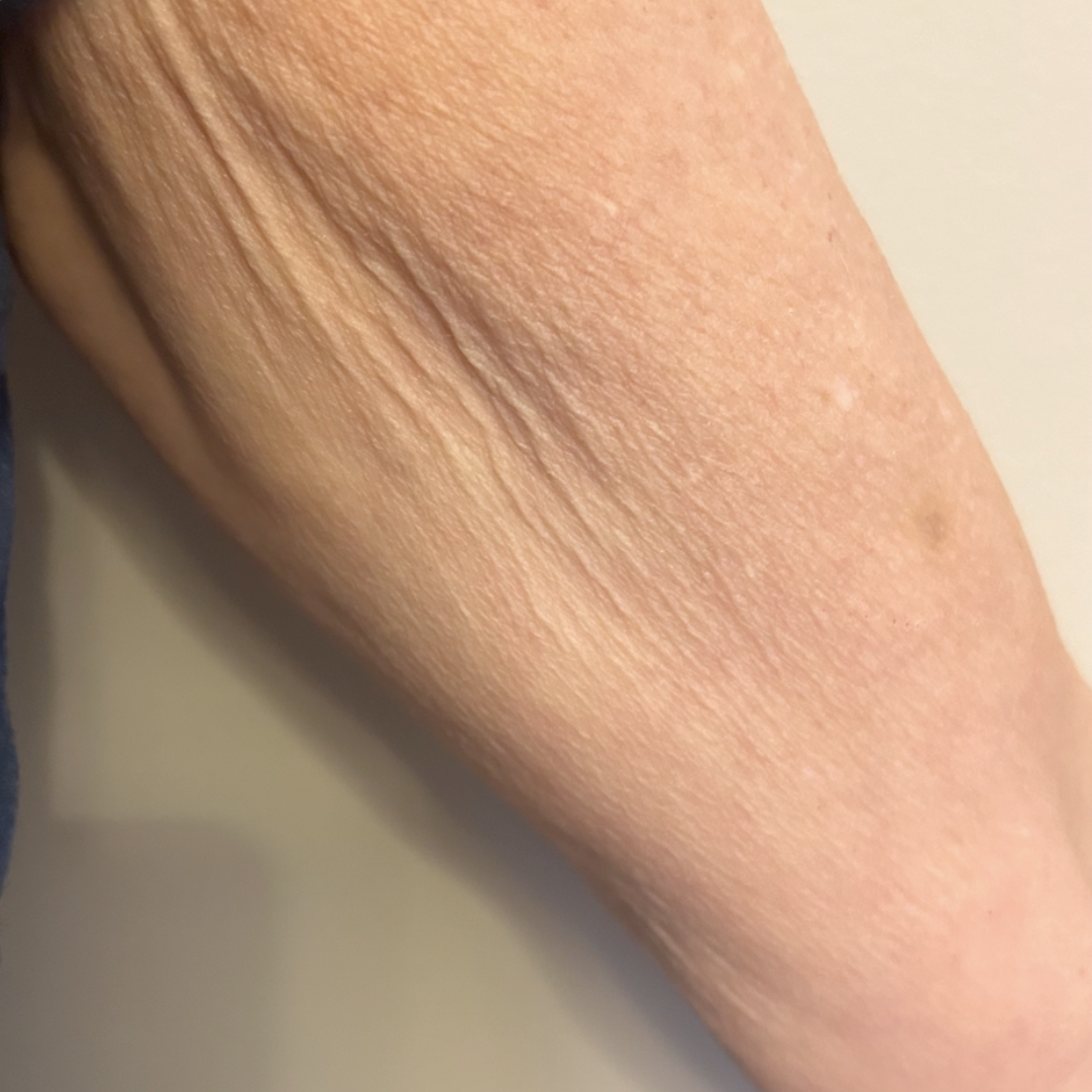 Before treatment
